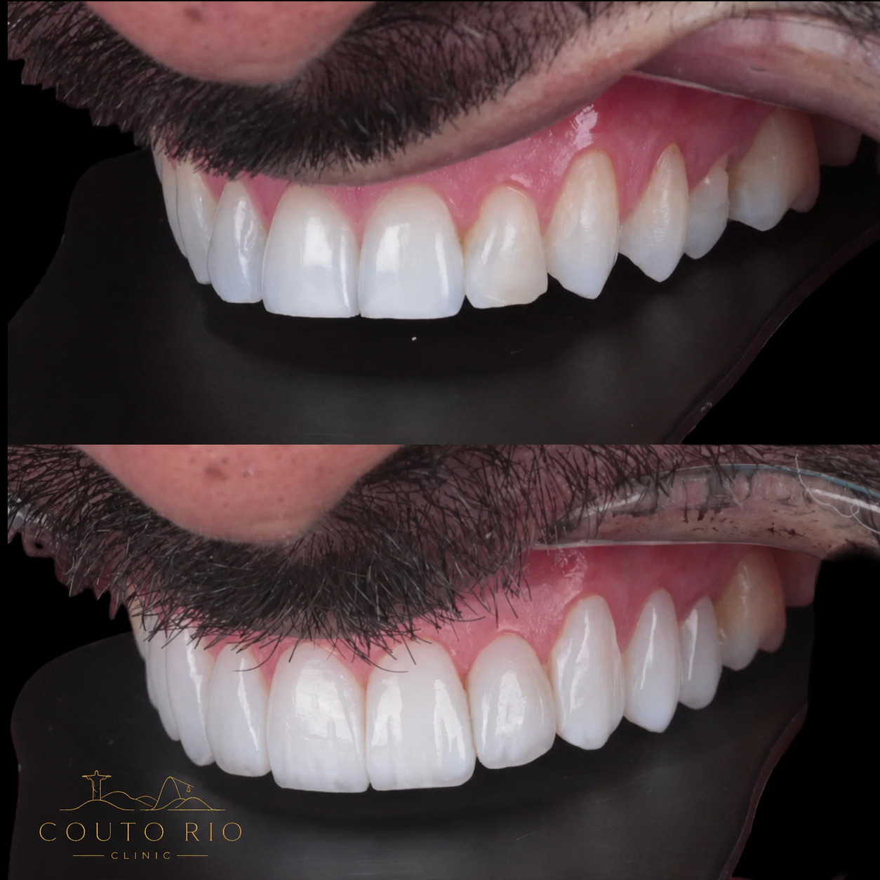 Resultado Couto Rio Clinic 2